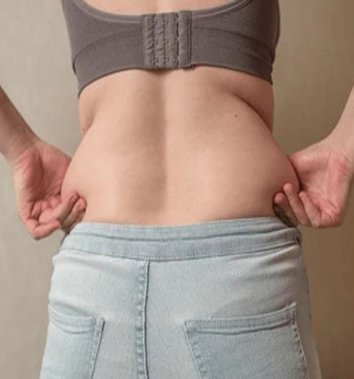 Picture of a woman showing her slim abdomen before a tummy tuck procedure in Costa Rica.
