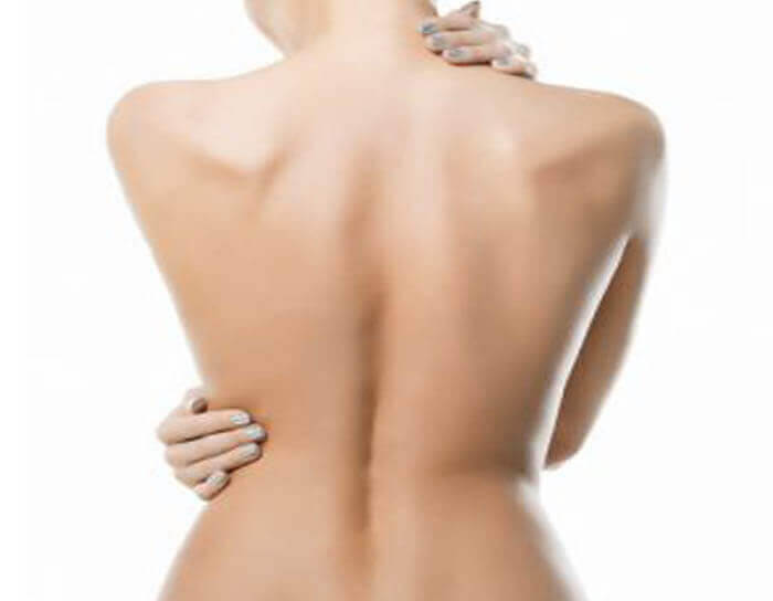 Picture of a woman's back showing the effect of an upper and lower back liposuction procedure.