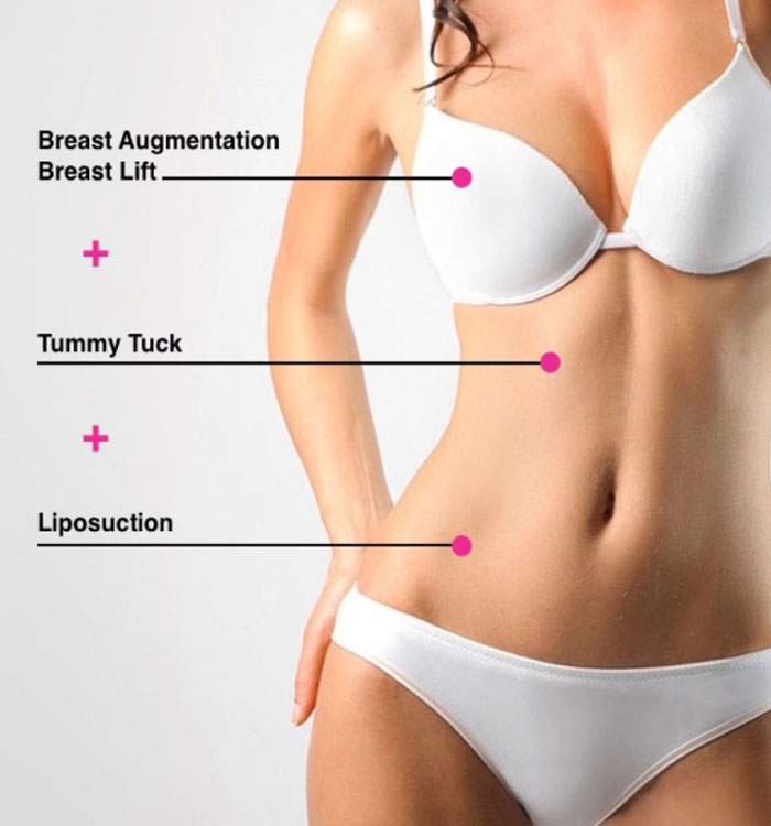 Picture of a woman showing her results after having a mommy makeover procedure in Costa Rica.